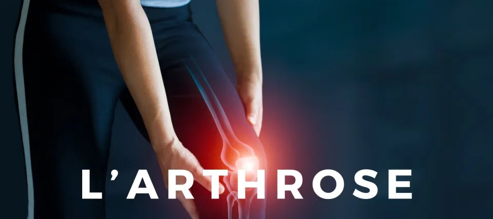 Comment venir à bout des douleurs causées par l'arthrose ?